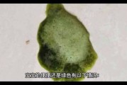 宝宝粑粑绿色有粘液怎么回事_需要看医生吗