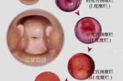 宫颈图片大全_正常与异常如何区分