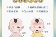 宝宝手足口病怎么护理_手足口病几天能好