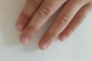 宝宝手指甲上有白点是怎么回事_指甲白点缺什么