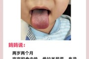 宝宝几个月会吐舌头_吐舌头是正常现象吗