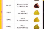 宝宝大便有黏液是怎么回事_宝宝大便颜色对照表