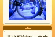 宝宝黄疸20怎么办_黄疸值20需要照蓝光吗