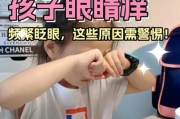 宝宝眼痒痒怎么回事_宝宝眼睛痒怎么快速止痒