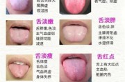 舌头图片大全_正常与异常舌象如何辨别