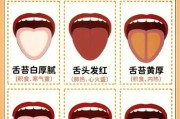 两岁宝宝舌苔厚白是怎么回事_怎么调理