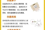 一个多月宝宝感冒怎么办_新生儿感冒鼻塞怎么缓解