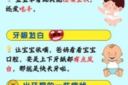 宝宝长牙慢怎么办_宝宝几个月长牙算晚