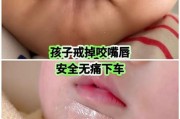 三个月宝宝裹下嘴唇正常吗_如何纠正