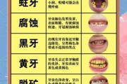 牙齿照片图片大全_如何辨别牙齿问题