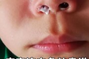 宝宝流白色粘鼻涕怎么办_白色粘鼻涕是感冒吗