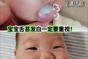 吃母乳的宝宝舌苔发白怎么回事_需要看医生吗