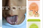宝宝舌头发紫是怎么回事_需要立即就医吗
