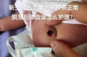 宝宝十天了脐带还没掉_脐带脱落延迟怎么办