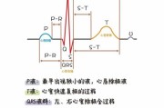 心电图怎么看_正常心电图图片大全