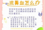 宝宝经常流鼻血是怎么回事_怎么快速止血