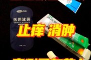 宝宝被蚊子咬了怎么办_如何快速止痒消肿