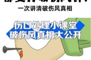 2岁宝宝打破伤风危害_需要打破伤风针吗