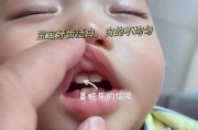 14个月宝宝牙齿有白斑怎么办_宝宝牙齿白斑会掉吗