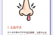 一岁多宝宝流鼻血怎么回事_宝宝流鼻血怎么办