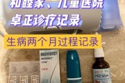 2岁宝宝过敏性鼻炎怎么治_2岁宝宝过敏性鼻炎用什么药
