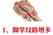 脚底板图片大全_脚底纹路图解