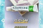 两岁宝宝脸上长癣怎么办_用什么药膏安全