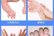 宝宝大拇指内扣是什么原因_需要干预吗