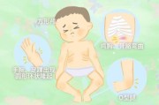 宝宝佝偻病早期症状有哪些_佝偻病怎么治疗最好