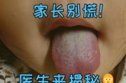 宝宝舌头白色厚厚一层_怎么办