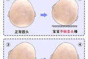 宝宝南北头图片_怎么判断偏头程度