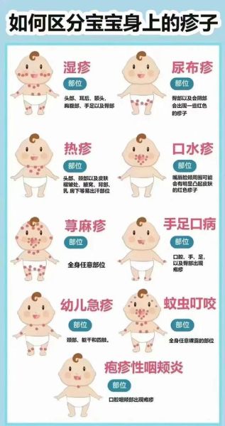 宝宝病毒性疙瘩图片_如何辨别与护理