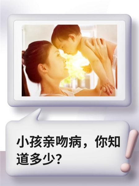 可以亲宝宝的嘴吗_婴儿亲吻安全指南