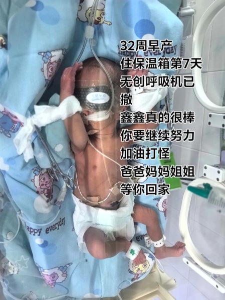 32周早产儿多久能出院_32周早产儿要住保温箱吗