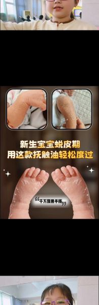 宝宝脚脱皮怎么回事_婴儿脚部脱皮原因