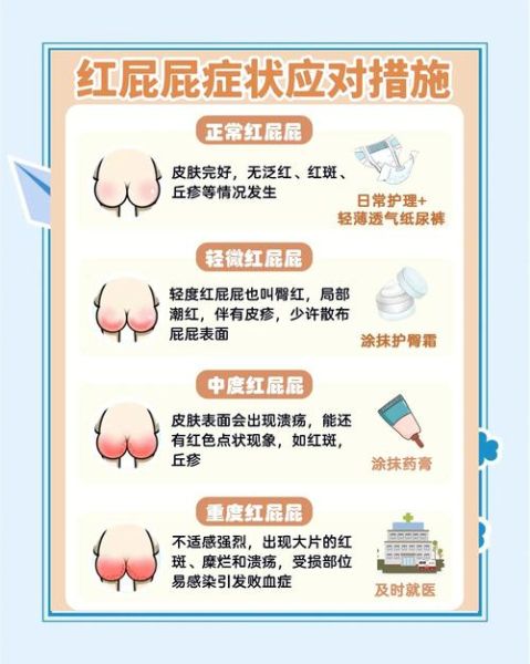 宝宝红屁屁怎么办_新生儿红屁屁图片解析