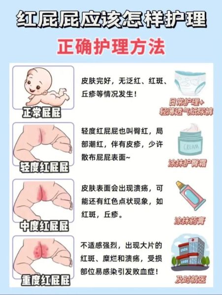 宝宝红屁屁怎么办_新生儿红屁屁图片解析