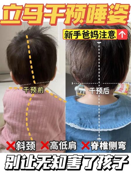 宝宝左斜颈正确睡姿图_怎么睡才安全