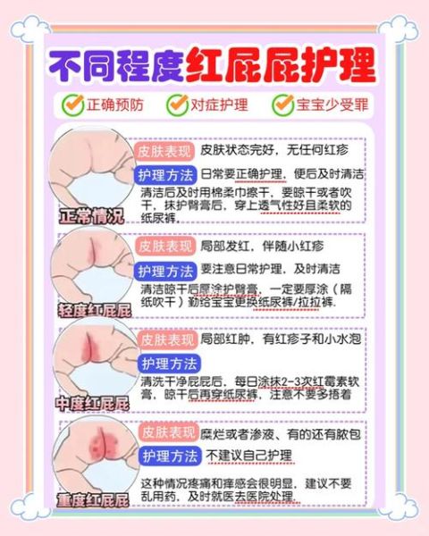 一岁宝宝屁眼红怎么办_红屁股护理方法