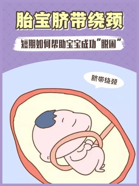 宝宝脐带绕颈怎么办_脐带绕颈一周能顺产吗