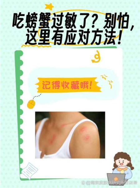 一岁宝宝可以吃螃蟹吗_螃蟹过敏症状