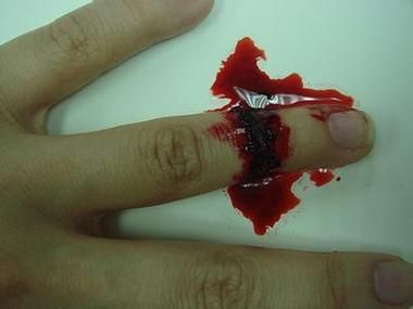 梦见自己流血是什么意思_梦见自己流血好不好