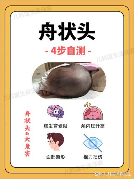 宝宝头很大正常吗_宝宝头大需要做什么检查