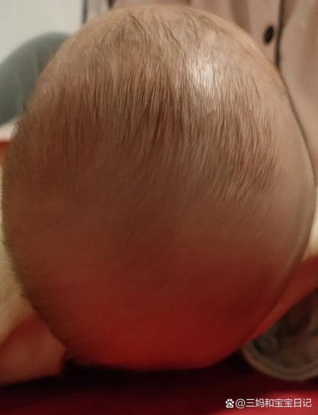 宝宝头很大正常吗_宝宝头大需要做什么检查