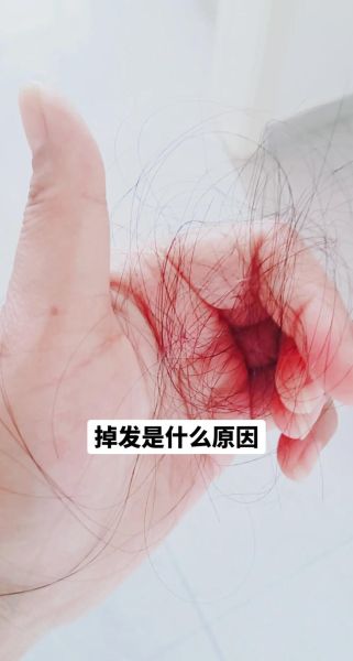 梦到掉头发是什么意思_梦见头发掉了一大把怎么办