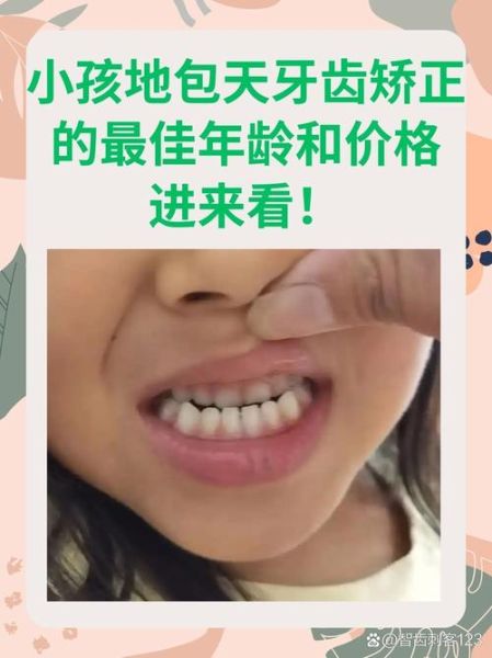 宝宝兜齿怎么办_兜齿几岁矫正最好