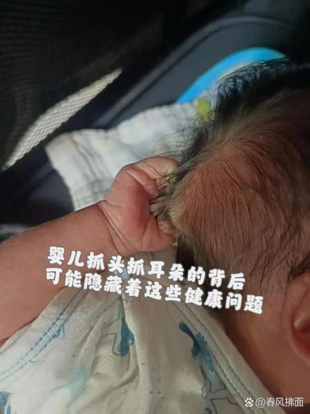宝宝老抓头是怎么回事_宝宝抓头会秃吗