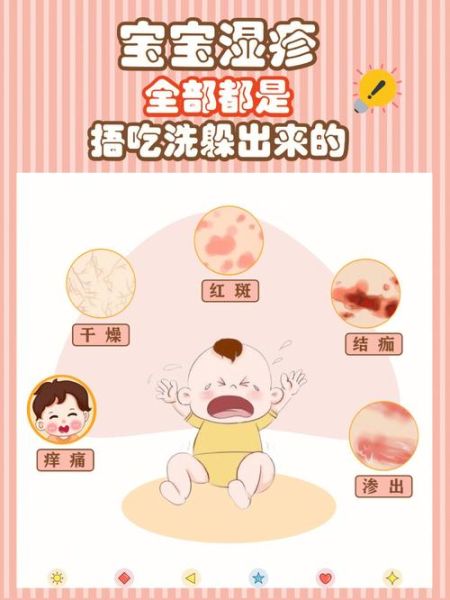 5个月宝宝脸上起红疹怎么办_婴儿湿疹护理方法