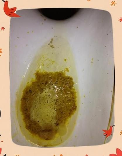 5个月宝宝大便有泡沫怎么回事_需要看医生吗