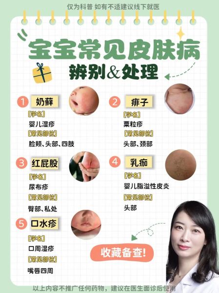 5个月宝宝脸上起红疹怎么办_婴儿湿疹护理方法